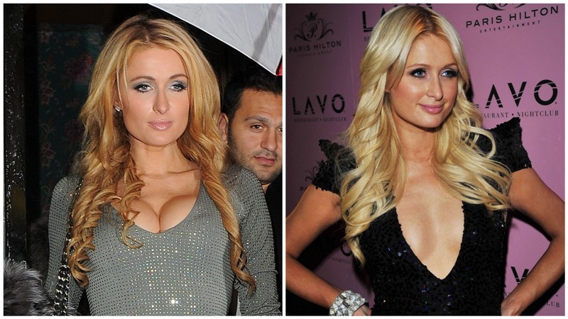 Paris Hilton sa zázračne zväčšilo poprsie